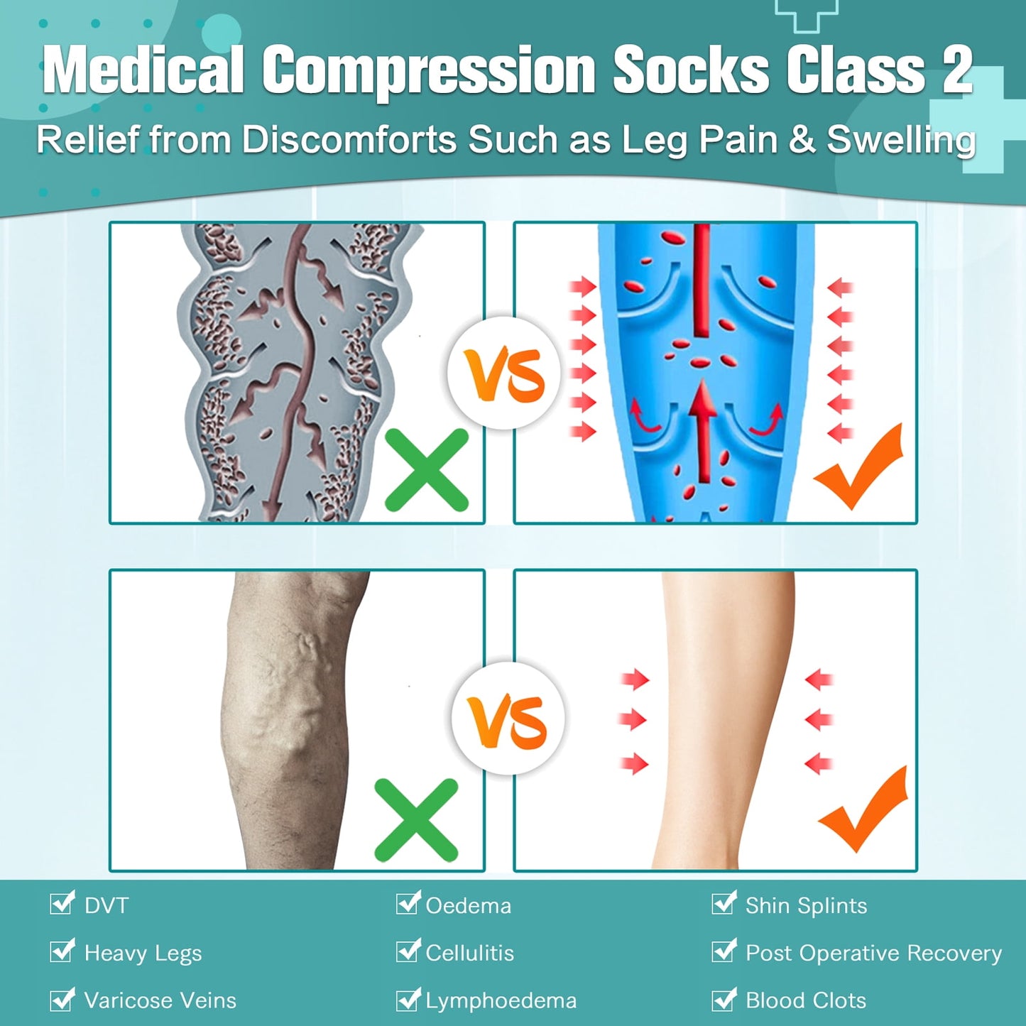 MARTINE MALL 2 Pairs Thigh High Zipper Compression Socks 20-30 Mmhg Closed Toe Compression Support Stockings for Pregnancy, Post-surgery, Swelling(Black+Beige)